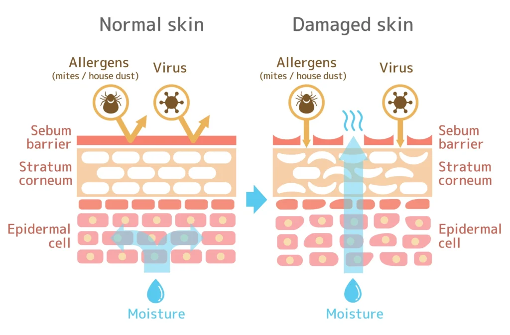 healthy skin barrier vs damaged skin barrier