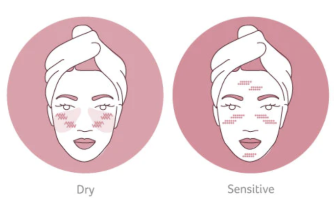 differences between dry and sensitive skin