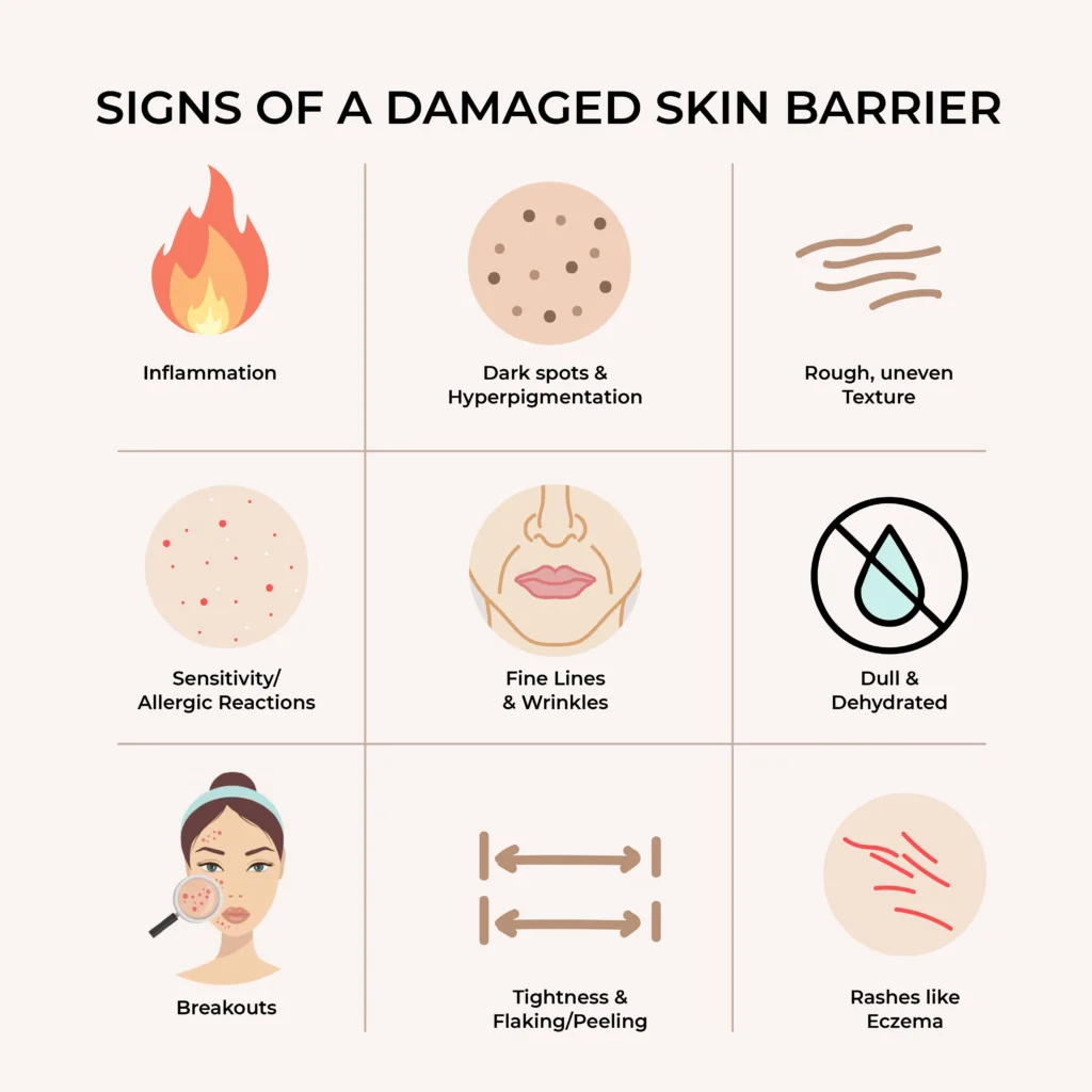 symptoms of skin barrier damage