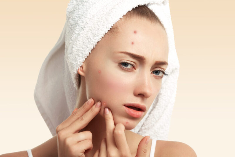 Preventing Pimples: A Complete Guide To Acne - Dr Skincare