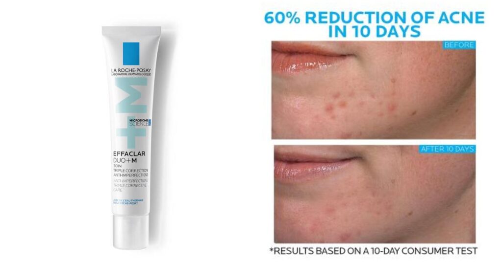 Summer Bum Acne Treatment derm-backed recommendation: La Roche‑Posay: Effaclar Duo [+] Spot Treatment 